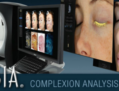 Visia Skin Analysis Test Can Lead to Better Skin!